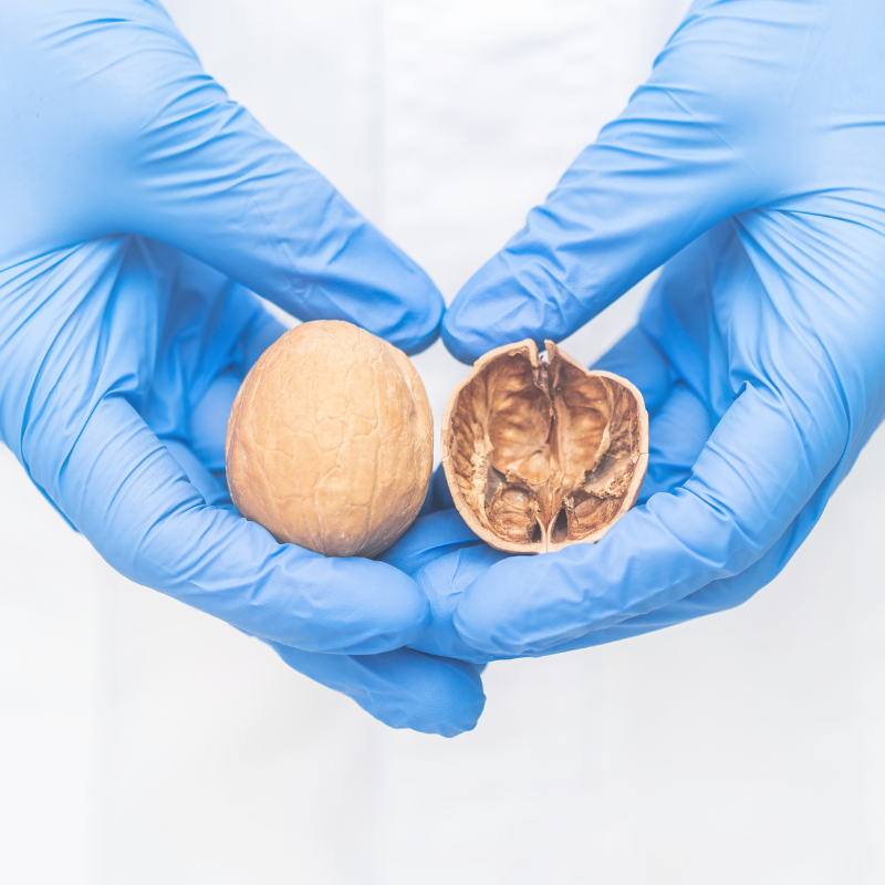 Diagnóstico e Tratamento do Câncer de Testículo: Entendendo os Subtipos e Opções de Terapia