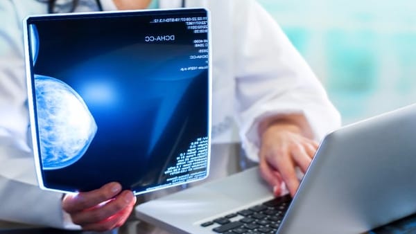 Inteligência artificial e o câncer de mama