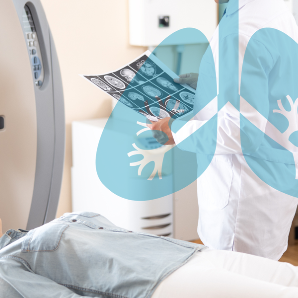 Como o Rastreio do Câncer de Pulmão Salva Vidas