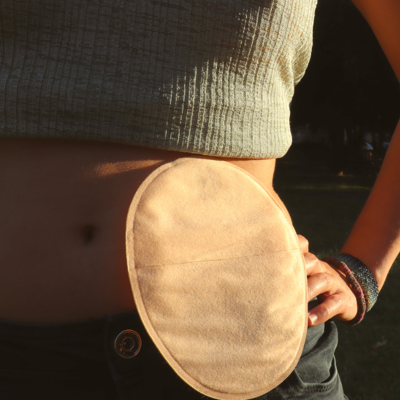 Uso de Colostomia após Cirurgias Oncológicas de Intestino - LCL MED